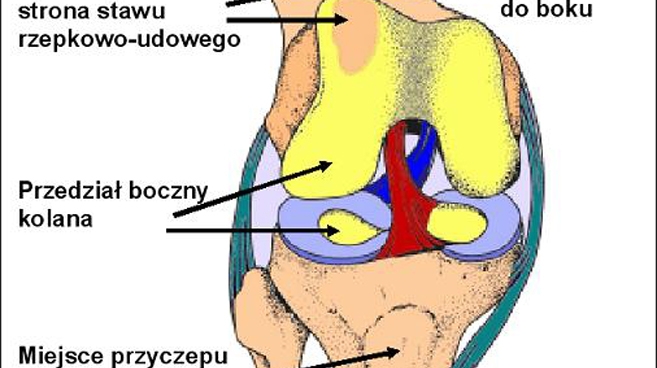 Stawy kolanowe źle znoszą przeciążenia. Trzeba więc dbać o linię i nie dźwigać ponad miarę
