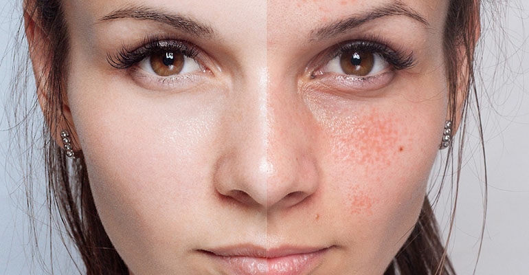 Rewolucja w makijażu permanentnym: BB Glow