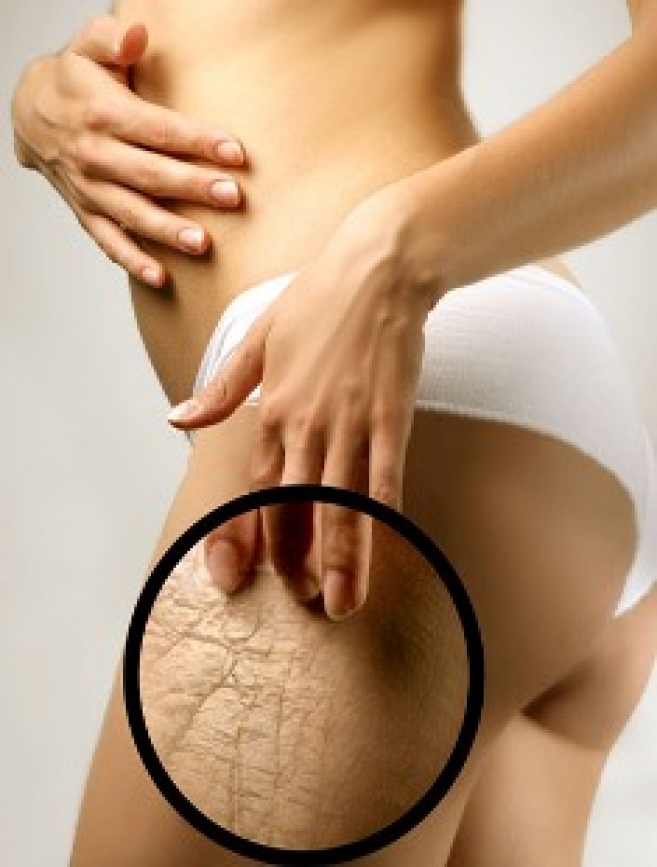 Aksamitne ciało bez cellulitu