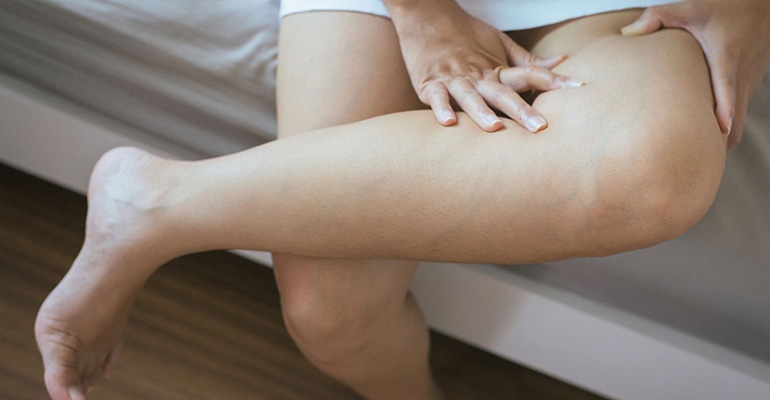 Jak rozpoznać zakrzepicę