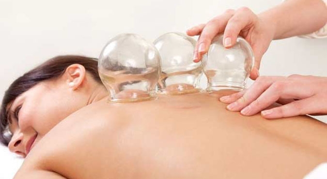 Bańki ogniowe może stawiać tylko doświadczona osoba (łatwo się oparzyć!)