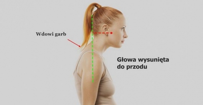 Czym jest wdowi garb?