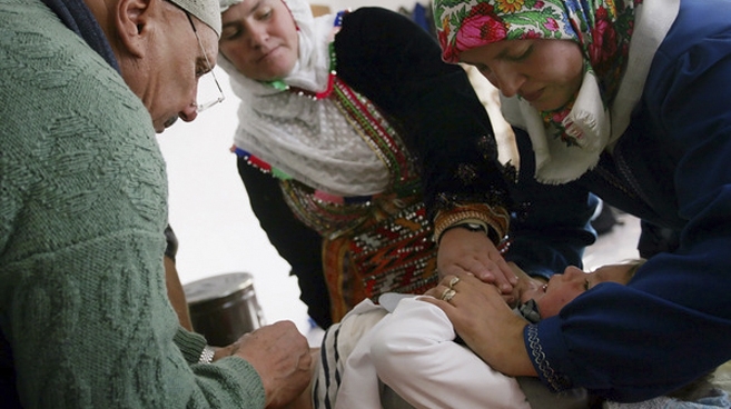 Najpowszechniej stosowanym sposobem rytualnego nacinania penisa jest obrzezanie