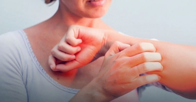 AZS to choroba całej rodziny