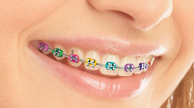 Ortodonta na nas czeka, kochanie