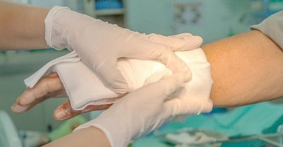 Owrzodzenia i oparzenia pierwsza pomoc