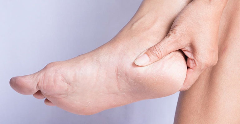 Zadbaj o suchą i pękającą skórę pięt